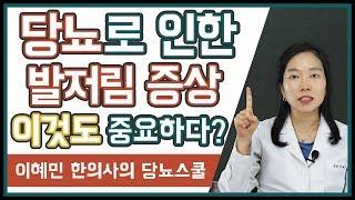 당뇨발저림 원인과 증상, 치료방법 | 말초신경병증이란?  (당뇨문의 1644-5178)