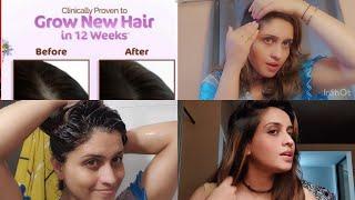 how to do applayhair serum and hair wash for Grow new hair in 12 week