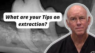 What are your Tips on extraction?