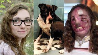 Dog-sitter recovering after a horrific Pit Bull attack