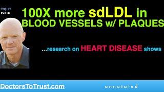 BEN BIKMAN | 100X more sdLDL in BLOOD VESSELS w/ PLAQUES   …research on HEART DISEASE shows