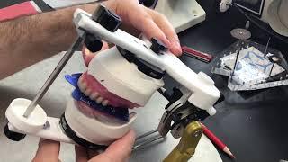 Setting Denture Teeth Using The OMP