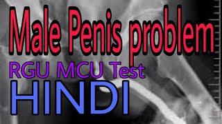 X Ray RGU and MCU Test Hindi | by  Radiographer guruji |