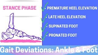 Gait Deviations: Ankle and Foot I Stance Phase of the Gait Cycle