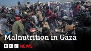 Malnutrition rises in Gaza as Israeli blockade enters third month | BBC News