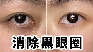 黑眼圈怪熬夜？找准原因，教你3分鐘告別黑眼圈！