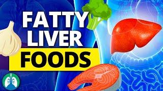 Top 10 Foods to Combat a Fatty Liver Naturally ️