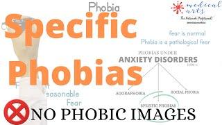 Specific phobia definitions, types, causes, diagnosis, treatments, self help, DSM-5.