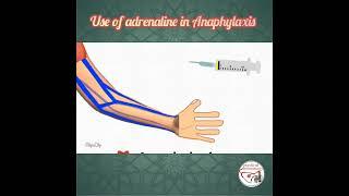  HOW TO USE ADRENALINE (EPINEPHRINE) IN ANAPHYLAXIS ? #pediatrics  #medicine #epinephrine