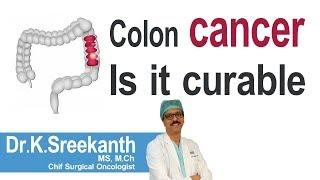 Hi9 | Colon cancer : Is it curable | Dr.K.Sreekanth | Surgical Oncologist