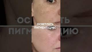 Уход за кожей лица профессиональной косметикой #ольгапетрунина #skincare  #кожалица #shorts