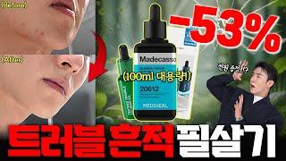 깔끔한 피부로 만들어주는 1티어 세럼!! 역대급 연말 할인 53% 털어왔습니다