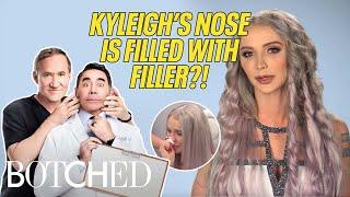 Kyleigh's Nose is Filled with FILLER & She Wants It Fixed! | Botched | E!