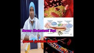 Cholesterol Test.Serum Cholesterol test.Procedure of serum cholesterol test.Lipid profile test by-