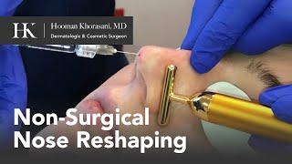 Non-Surgical Rhinoplasty - Dr. Hooman Khorasani