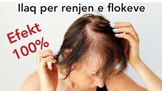 ILAQ NATYRAL PER RENJEN E FLOKEVE | 100% EFEKT | Maska per floke | #floket #receta #hairgrowth