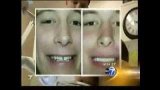 Chicago Cosmetic Dentist ABC News Spotlight