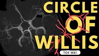 Circle of Willis Anatomy | Radiology anatomy part 1 prep | TOF MR angiogram