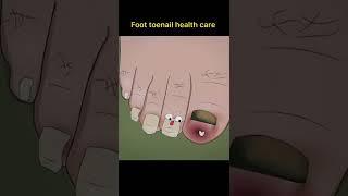 foot toenail health care