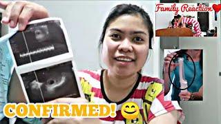 NAG PA ULTRASOUND NA AKO|FIRST TRIMESTER