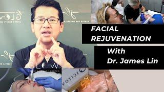 Facial Rejuvenation with Dr. James Lin