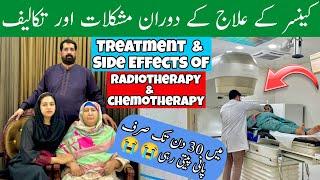 Treatments Of Cancer | SIDE EFFECTS Of Radiotherapy | BaBa Food RRC | Chef Rizwan