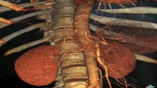 Amazing 3D Anatomy HD