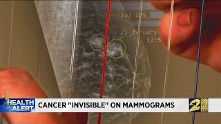 Cancer 'invisible' on mammograms