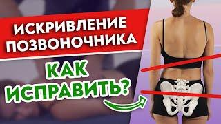 Как исправить искривление позвоночника и перекос таза?