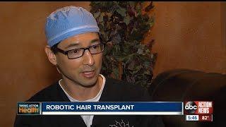 Artas Robotic Hair Transplant in Florida - Hair Restoration Florida