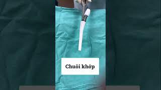 Thay khớp háng chỏm sứ lót nhựa polyetylen BS Hà bv Việt Đức ĐT, zalo 0983863126
