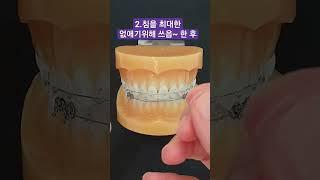 #교정환자왁스사용법 #How to use wax for orthodontic patients #shorts