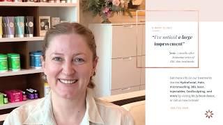 Josie's BBL Treatment Experience at 8 West Clinic, Vancouver BC