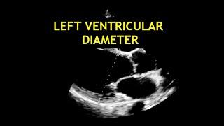 How to measure the LEFT VENTRICULAR DIAMETER: Echocardiography!