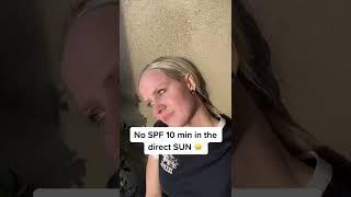 No SPF 10 mins in the direct SUN ️ #Mitochondria #Sunhealing #Sunrays