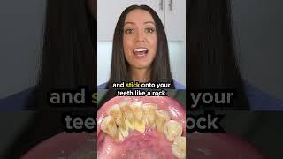 dental tartar vs dental plaque #shorts