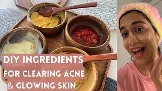 DIY Face Masks for Clear, Acne-prone and Glowing Skin | DIY Skincare