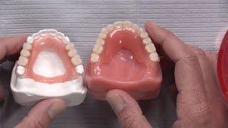 Case of the week: Never Before Seen Partial Denture Material