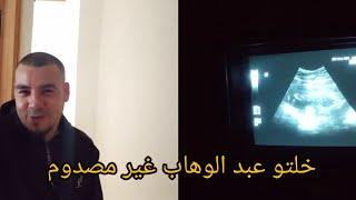 فضحت المفاجات خليت عبد الوهاب مصدوم والله منخبع عليكوم ‍‍‍