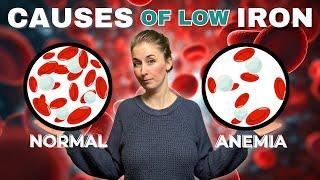 Top 10 CAUSES Of Iron Deficiency & Anemia