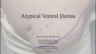 Atypical Ventral Hernia