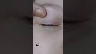 #kreepy #wite eye #no pupl