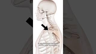 How Do You Find The Infraspinatus Muscle?