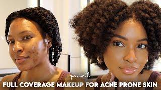 10 MINUTE EVERYDAY FULL COVERAGE MAKEUP FOR ACNE PRONE, TEXTURED SKIN | KENSTHETIC