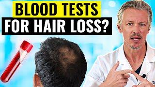 Do YOU need blood tests for your hair loss?