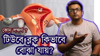 ফ্যালোপিয়ান টিউবে ব্লক আছে কি করে বোঝা যায় | Symptoms | Fallopian tube block | The Bong Parenting