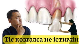 Тістер босап қалса! Тістер сақтап қалу үшін…