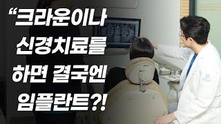 크라운이나 신경치료를 하면 치아의 수명이 줄어서 임플란트를 해야 한다던데....