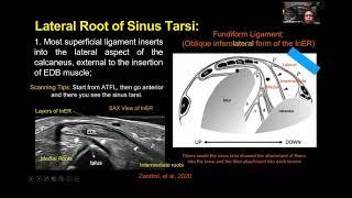 Dr. Jeimylo de Castro talks about advance MSK Ultrasound of the Midfoot ligaments