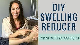 SIMPLE DIY Lymph Drainage | Reflexology Point for Lymphedema, Swelling and Edema